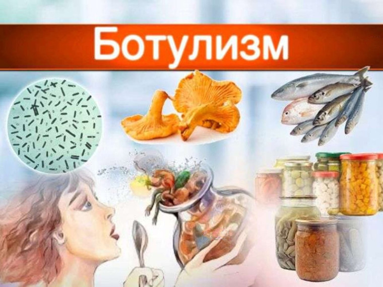 Внимание ботулизм!.
